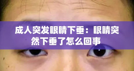 成人突发眼睛下垂：眼睛突然下垂了怎么回事 